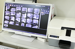 デジタルレントゲン（Digitral X-ray)